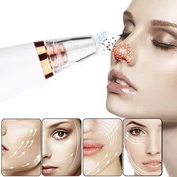 Beauty Face - Succionador de poros